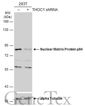 Non-transfected (–) and transfected (+) 293T whole cell extracts (30 μg) were separated by 7.5% SDS-PAGE, and the membrane was blotted with Nuclear Matrix Protein p84 antibody (GTX118740) diluted at 1:2000. The HRP-conjugated anti-rabbit IgG antibody (GTX213110-01) was used to detect the primary antibody, and the signal was developed with Trident ECL plus-Enhanced.