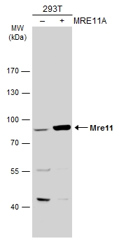 Immunohistochemical analysis of paraffin-embedded BT474 xenograft,using Mre11(GTX118741) antibody at 1:500 dilution. Antigen Retrieval: Trilogy? (EDTA based,pH 8.0) buffer,15min