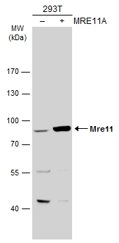 Non-transfected (–) and transfected (+) 293T whole cell extracts (30 μg) were separated by 7.5% SDS-PAGE, and the membrane was blotted with Mre11 antibody (GTX118741) diluted at 1:1000. The HRP-conjugated anti-rabbit IgG antibody (GTX213110-01) was used to detect the primary antibody.