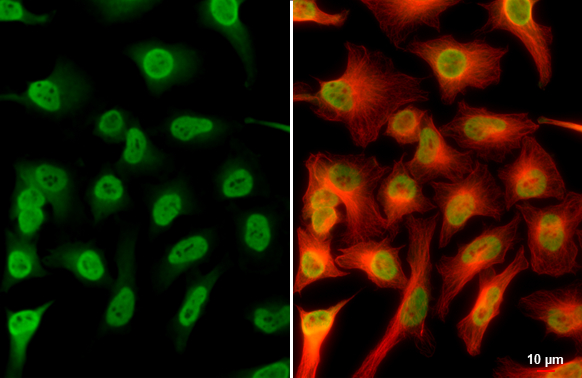 Mre11 antibody detects Mre11 protein at nucleus by immunofluorescent analysis. Sample: HeLa cells were fixed in 4% paraformaldehyde at RT for 15 min. Green: Mre11 stained by Mre11 antibody (GTX118741) diluted at 1:500. Red: alpha Tubulin, a cytoskeleton marker, stained by alpha Tubulin antibody [GT114] (GTX628802) diluted at 1:1000. Scale bar= 10μm.