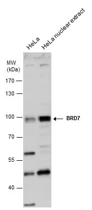 BRD7 antibody detects BRD7 protein by western blot analysis. HeLa whole cell extracts and nuclear extracts (30 μg) were separated by 7.5% SDS-PAGE, and the membrane was blotted with BRD7 antibody (GTX118755) diluted at 1:500.