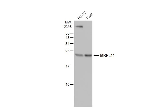 Various whole cell extracts (30 μg) were separated by 15% SDS-PAGE, and the membrane was blotted with MRPL11 antibody [N1C3] (GTX118773) diluted at 1:500. The HRP-conjugated anti-rabbit IgG antibody (GTX213110-01) was used to detect the primary antibody.