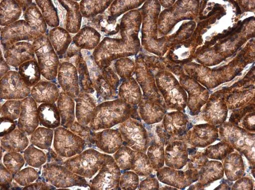 IVNS1ABP antibody detects IVNS1ABP protein at cytoplasm in mouse kidney by immunohistochemical analysis. Sample: Paraffin-embedded mouse kidney. IVNS1ABP antibody (GTX118817) diluted at 1:500. 
 Antigen Retrieval: Trilogy? (EDTA based, pH 8.0) buffer, 15min