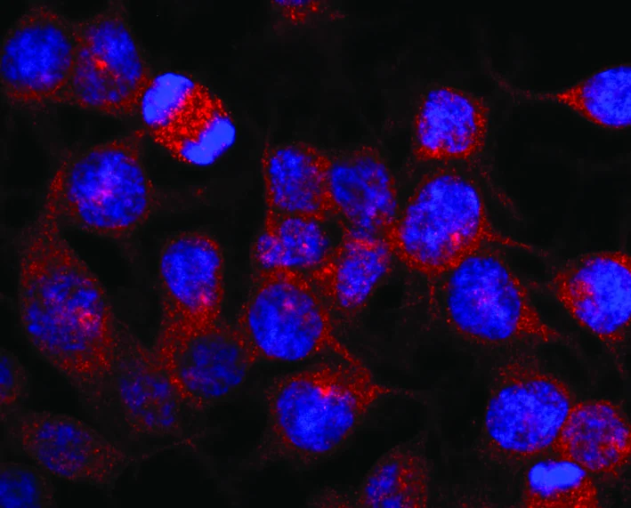 Immunofluorescence staining of vesicles (red) in RBL-2H3 rat basophilic leukemia cell line using anti-Kinesin (GTX11883). Nuclei were stained with DAPI (blue).