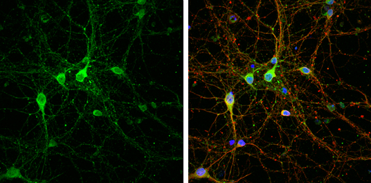 LINGO1 antibody [C1C3] detects LINGO1 protein by immunofluorescent analysis. Sample: DIV9 rat E18 primary cortical neuron cells were fixed in 4% paraformaldehyde at RT for 15 min. Green: LINGO1 stained by LINGO1 antibody [C1C3] (GTX118853) diluted at 1:500. Red: beta Tubulin 3/ Tuj1, stained by beta Tubulin 3/ Tuj1 antibody [GT1338] (GTX631831) diluted at 1:500. Blue: Fluoroshield with DAPI (GTX30920).