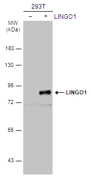 Non-transfected (–) and transfected (+) 293T whole cell extracts (30 μg) were separated by 7.5% SDS-PAGE, and the membrane was blotted with LINGO1 antibody [C1C3] (GTX118853) diluted at 1:1000. The HRP-conjugated anti-rabbit IgG antibody (GTX213110-01) was used to detect the primary antibody.