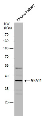 Mouse tissue extract (50 μg) was separated by 10% SDS-PAGE, and the membrane was blotted with GNA11 antibody [N3C3] (GTX118876) diluted at 1:1000.
