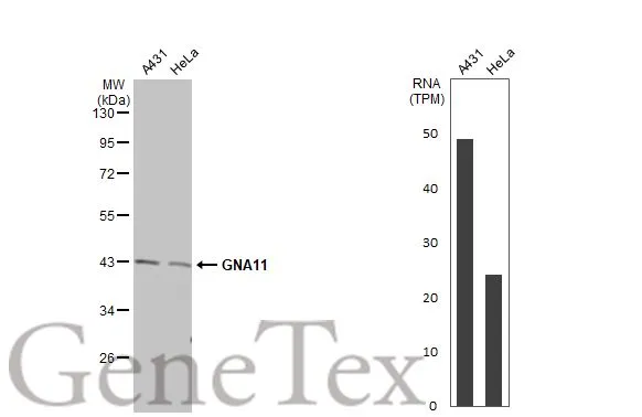 Various whole cell extracts (30 μg) were separated by 10% SDS-PAGE, and the membrane was blotted with GNA11 antibody [N3C3] (GTX118876) diluted at 1:1000. The HRP-conjugated anti-rabbit IgG antibody (GTX213110-01) was used to detect the primary antibody. Corresponding RNA expression data for the same cell lines are based on Human Protein Atlas program.