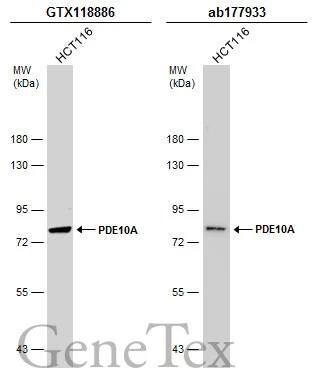Whole cell extract (30 μg) was separated by 7.5% SDS-PAGE, and the membranes were blotted with PDE10A antibody [C2C3], C-term (GTX118886) diluted at 1:1000 and competitor's antibody (ab177933) diluted at 1:200. The HRP-conjugated anti-rabbit IgG antibody (GTX213110-01) was used to detect the primary antibody. *The competitor is not affiliated with GeneTex and does not endorse this product.
