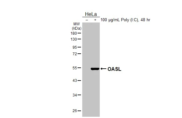 Untreated (–) and treated (+) HeLa whole cell extract (30 μg) were separated by 10% SDS-PAGE, and the membrane was blotted with OASL antibody [N1C1] (GTX118999) diluted at 1:1000. The HRP-conjugated anti-rabbit IgG antibody (GTX213110-01) was used to detect the primary antibody.