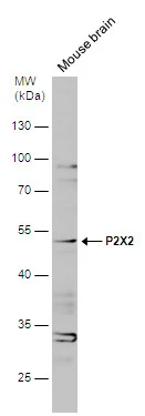 Mouse tissue extract (50 μg) was separated by 10% SDS-PAGE, and the membrane was blotted with P2X2 antibody [N1C1] (GTX119003) diluted at 1:500.