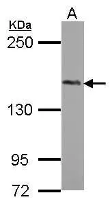 Sample (50 ug of whole cell lysate) A: mouse brain 5% SDS PAGE GTX119004 diluted at 1:2000