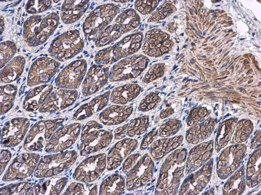 PTPRH antibody [C2C3], C-term detects PTPRH protein at cytoplasm in rat colon by immunohistochemical analysis. Sample: Paraffin-embedded rat colon. PTPRH antibody [C2C3], C-term (GTX119064) diluted at 1:500. 
 Antigen Retrieval: Citrate buffer, pH 6.0, 15 min