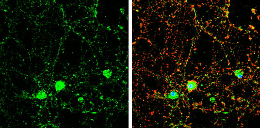 DOC2A antibody [N2C3] detects DOC2A protein by immunofluorescent analysis. Sample: DIV9 rat E18 primary cortical neuron cells were fixed in 4% paraformaldehyde at RT for 15 min. Green: DOC2A stained by DOC2A antibody [N2C3] (GTX119085) diluted at 1:500. Red: beta Tubulin 3/ Tuj1, stained by beta Tubulin 3/ Tuj1 antibody [GT1338] (GTX631831) diluted at 1:500. Blue: Fluoroshield with DAPI (GTX30920).
