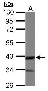 Sample (50 ug of whole cell lysate) A: Mouse brain 10% SDS PAGE GTX119085 diluted at 1:1000 Sample (50 ug of whole cell lysate) A: Mouse brain 10% SDS PAGE GTX119085 diluted at 1:1000