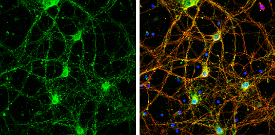 SEPT8 antibody detects SEPT8 protein by immunofluorescent analysis. Sample: DIV9 rat E18 primary cortical neurons were fixed in 4% paraformaldehyde at RT for 15 min. Green: SEPT8 protein stained by SEPT8 antibody (GTX119118) diluted at 1:500. Red: beta Tubulin 3/ Tuj1, stained by beta Tubulin 3/ Tuj1 antibody [GT886] (GTX631830) diluted at 1:500. Blue: Fluoroshield with DAPI (GTX30920).