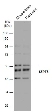 Various tissue extracts (10 μg) were separated by 10% SDS-PAGE, and the membrane was blotted with SEPT8 antibody (GTX119118) diluted at 1:4000. The HRP-conjugated anti-rabbit IgG antibody (GTX213110-01) was used to detect the primary antibody.