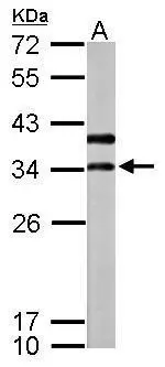 Sample (50 ug of whole cell lysate) A: mouse brain 12% SDS PAGE GTX119155 diluted at 1:1000