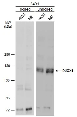 Boiled and unboiled A431 whole cell and membrane extracts (30 μg) were separated by 5% SDS-PAGE, and the membrane was blotted with DUOX1 antibody [N1N3] (GTX119160) diluted at 1:1000. The HRP-conjugated anti-rabbit IgG antibody (GTX213110-01) was used to detect the primary antibody. (WCE: whole cell extract; ME: membrane extract)