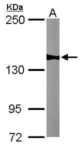 WDR19 antibody [N1N2], N-term