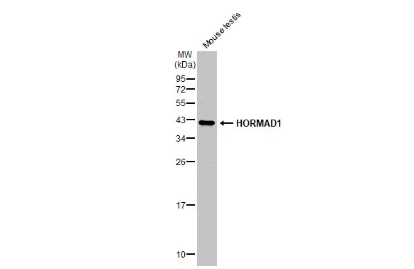 Mouse tissue extract (50 μg) was separated by 12% SDS-PAGE, and the membrane was blotted with HORMAD1 antibody [N2C2], Internal (GTX119236) diluted at 1:1000. The HRP-conjugated anti-rabbit IgG antibody (GTX213110-01) was used to detect the primary antibody.