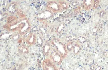 Anti-ZNF598 antibody [N1N3] (GTX119245) | GeneTex