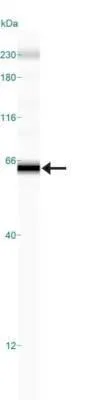 WB analysis of Daudi cell lysate using GTX11931 DR4 antibody [32A1380].