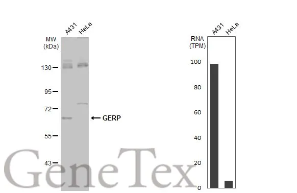 Various whole cell extracts (30 μg) were separated by 7.5% SDS-PAGE, and the membrane was blotted with GERP antibody (GTX119312) diluted at 1:500. The HRP-conjugated anti-rabbit IgG antibody (GTX213110-01) was used to detect the primary antibody, and the signal was developed with Trident ECL plus-Enhanced. Corresponding RNA expression data for the same cell lines are based on Human Protein Atlas program.