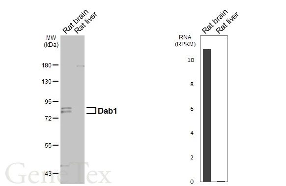 Various tissue extracts (50 μg) were separated by 7.5% SDS-PAGE, and the membrane was blotted with Dab1 antibody [N1N3] (GTX119336) diluted at 1:1000. The HRP-conjugated anti-rabbit IgG antibody (GTX213110-01) was used to detect the primary antibody. Corresponding RNA expression data are based on NCBI database.