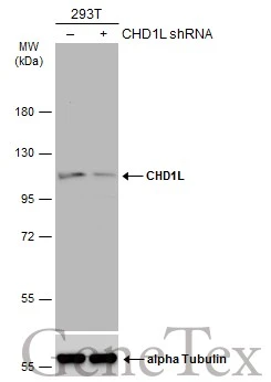 Non-transfected (–) and transfected (+) 293T whole cell extracts (30 μg) were separated by 7.5% SDS-PAGE, and the membrane was blotted with CHD1L antibody [N2C1], Internal (GTX119360) diluted at 1:5000. The HRP-conjugated anti-rabbit IgG antibody (GTX213110-01) was used to detect the primary antibody.