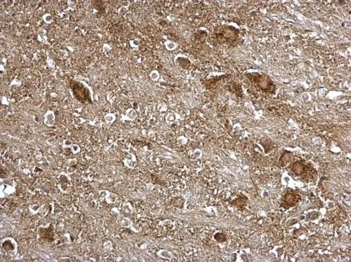 ITM2B antibody detects ITM2B protein at Golgi apparatus on mouse esophagus by immunohistochemical analysis. Sample: Paraffin-embedded mouse brain stem. ITM2B antibody (GTX119361) dilution: 1:500. 
 Antigen Retrieval: Trilogy? (EDTA based, pH 8.0) buffer, 15min