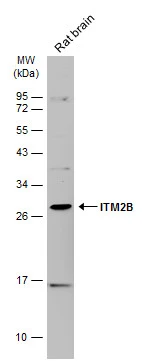 Rat tissue extract (50 ug) was separated by 12% SDS-PAGE,and the membrane was blotted with ITM2B antibody (GTX119361) diluted at 1:1000. The HRP-conjugated anti-rabbit IgG antibody (GTX213110-01) was used to detect the primary antibody.