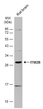 ITM2B antibody