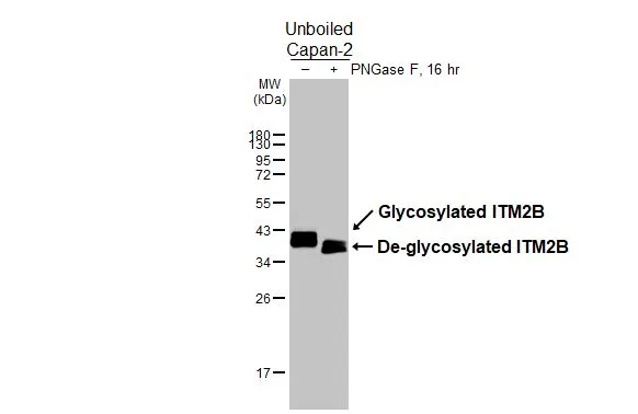 Untreated (–) and treated (+) unboiled Capan-2 whole cell extracts (30 μg) were separated by 12% SDS-PAGE, and the membrane was blotted with ITM2B antibody (GTX119361) diluted at 1:1000. The HRP-conjugated anti-rabbit IgG antibody (GTX213110-01) was used to detect the primary antibody.