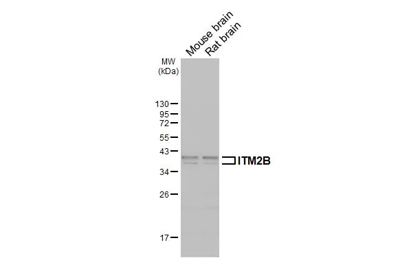 Various tissue extracts (50 μg) were separated by 12% SDS-PAGE, and the membrane was blotted with ITM2B antibody (GTX119361) diluted at 1:500. The HRP-conjugated anti-rabbit IgG antibody (GTX213110-01) was used to detect the primary antibody.