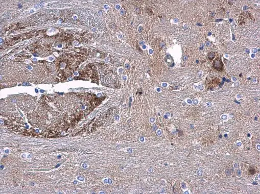 AAMP antibody detects AAMP protein at cytoplasm in mouse middle brain by immunohistochemical analysis. Sample: Paraffin-embedded mouse middle brain. AAMP antibody (GTX119410) diluted at 1:500. 
 Antigen Retrieval: Citrate buffer, pH 6.0, 15 min