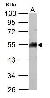 AAMP antibody detects AAMP protein by Western blot analysis. A. 50 μg mosue brain lysate/extract 10 % SDS-PAGE AAMP antibody (GTX119410) dilution: 1:1000