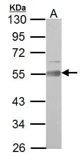 AAMP antibody detects AAMP protein by Western blot analysis. A. 50 μg Rat brain lysate/extract 10 % SDS-PAGE AAMP antibody (GTX119410) dilution: 1:1000