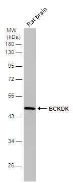 Rat tissue extract (50 μg) was separated by 10% SDS-PAGE, and the membrane was blotted with BCKDK antibody [N1C2] (GTX119413) diluted at 1:1000.