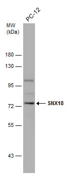 Whole cell extract (30 μg) was separated by 7.5% SDS-PAGE, and the membrane was blotted with SNX18 antibody (GTX119426) diluted at 1:1000.