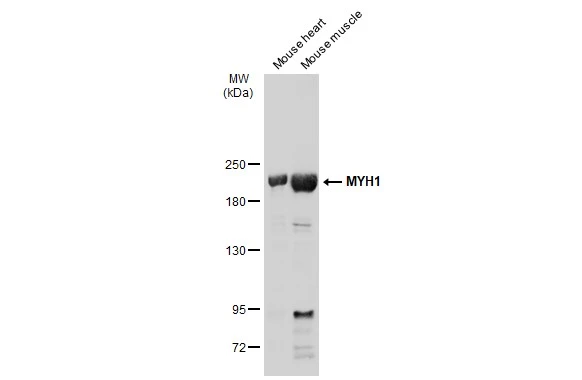 Various tissue extracts (50 μg) were separated by 5% SDS-PAGE, and the membrane was blotted with MYH1 antibody [N1], N-term (GTX119435) diluted at 1:500. The HRP-conjugated anti-rabbit IgG antibody (GTX213110-01) was used to detect the primary antibody.