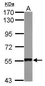 Sample (50 ug of whole cell lysate) A: mouse heart 7.5% SDS PAGE GTX119484 diluted at 1:10000 Sample (50 ug of whole cell lysate) A: mouse heart 7.5% SDS PAGE GTX119484 diluted at 1:10000