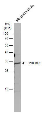 Mouse tissue extract (50 μg) was separated by 12% SDS-PAGE, and the membrane was blotted with ALP / PDLIM3 antibody (GTX119505) diluted at 1:10000. The HRP-conjugated anti-rabbit IgG antibody (GTX213110-01) was used to detect the primary antibody.