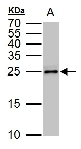 TPPP antibody detects TPPP protein by western blot analysis. A. 50 μg rat brain lysate/extract 15 % SDS-PAGE TPPP antibody (GTX119520) dilution: 1:1000