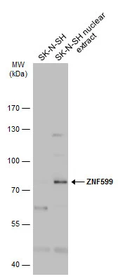 SK-N-SH whole cell and nuclear extracts (30 μg) were separated by 7.5% SDS-PAGE, and the membrane was blotted with ZNF599 antibody (GTX119526) diluted at 1:2000. The HRP-conjugated anti-rabbit IgG antibody (GTX213110-01) was used to detect the primary antibody.