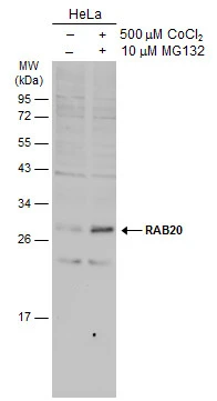 RAB20 antibody [N1C3]