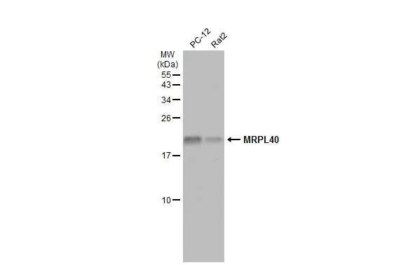 Various whole cell extracts (30 μg) were separated by 15% SDS-PAGE, and the membrane was blotted with MRPL40 antibody (GTX119564) diluted at 1:500. The HRP-conjugated anti-rabbit IgG antibody (GTX213110-01) was used to detect the primary antibody.