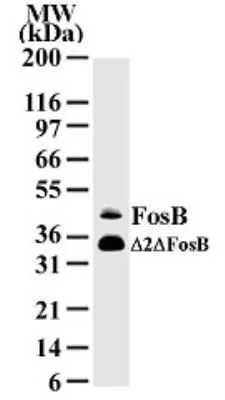 WB analysis of HeLa cell lysate using GTX11959 Fos B antibody [83B1138].