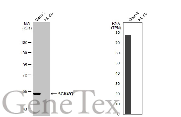 Various whole cell extracts (30 μg) were separated by 7.5% SDS-PAGE, and the membrane was blotted with SGK493 antibody [N2C2], Internal (GTX119593) diluted at 1:1000. The HRP-conjugated anti-rabbit IgG antibody (GTX213110-01) was used to detect the primary antibody. Corresponding RNA expression data for the same cell lines are based on Human Protein Atlas program.