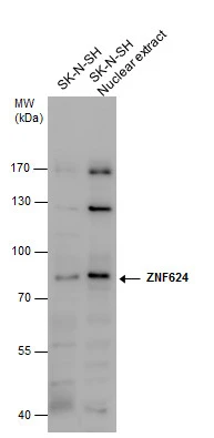 ZNF624 antibody detects ZNF624 protein by western blot analysis. SK-N-SH whole cell extracts and nuclear extracts (30 μg) were separated by 7.5% SDS-PAGE, and the membrane was blotted with ZNF624 antibody (GTX119609) at a dilution of 1:500.